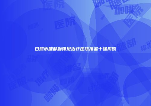 日照市腿部咖啡斑治疗医院排名十强揭晓